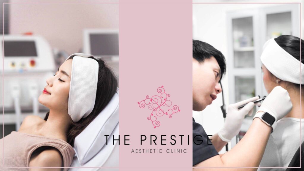 Prestige Clinic ปรึกษา Thermage ฟรี ไม่เสียค่าใช้จ่าย 